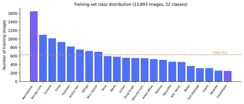 Bar chart of training images per class for 22 skin conditions, sorted from the largest class to the smallest, with a dashed line marking the mean.