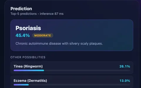 Prediction panel of the in-browser skin disease detection app from an M.E. project: the top result with confidence and severity, ranked alternatives and an 87 ms inference time.