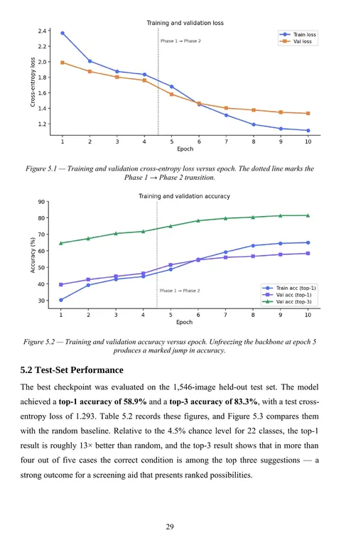 Results chapter page from the dissertation of a delivered M.E. skin disease detection project, with training and validation loss and accuracy curves across two training phases.