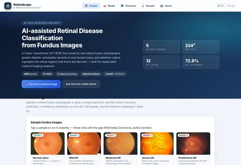 Home screen of the retinal disease classifier web app, with model summary cards and sample fundus images for each grade.