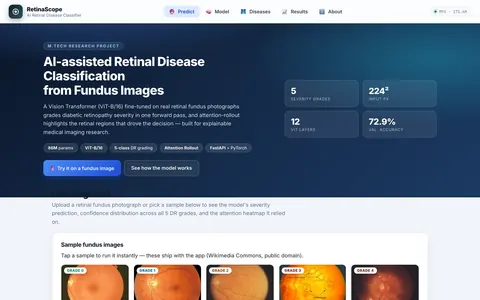 Home screen of the retinal disease classifier: ViT-B/16 model summary cards and a gallery of sample fundus images, one for each diabetic retinopathy grade.